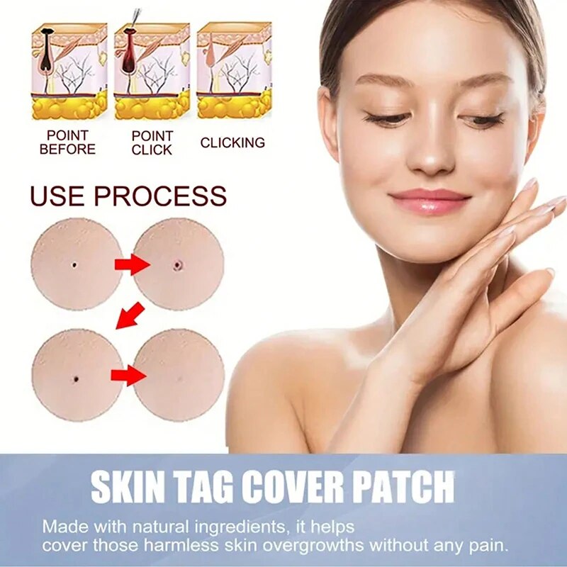 CoverLux™ Náplasti na odstraňování kožních značek a znamének