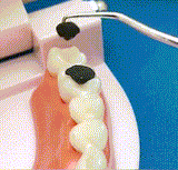 DentaHealth+™️ Přenosná sada na čištění zubů | Čerstvé zuby vždy a všude!